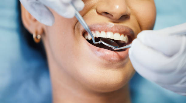 Best Emergency Pediatric Dental Care in Granite Bay, CA