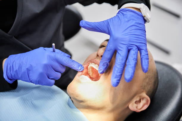 Best Emergency Root Canal Therapy in Granite Bay, CA