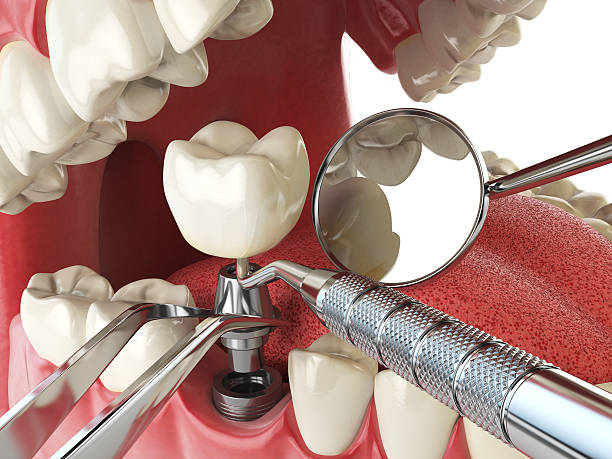 Best Emergency Treatment for Oral Infections in Granite Bay, CA